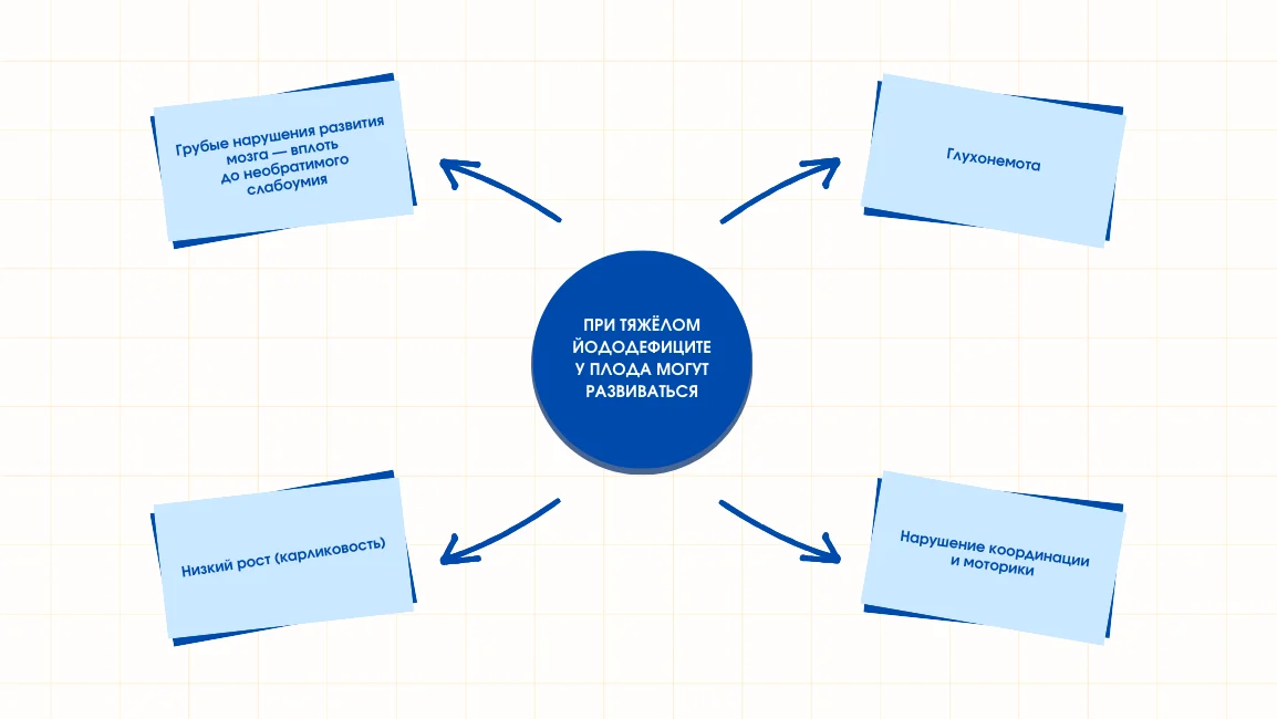 Иллюстрация последствий йододефицита